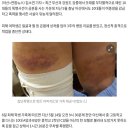 아산서도 10대 집단폭행..여중생 1시간 넘게 감금하고 때려 이미지