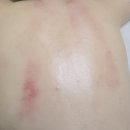 황금뷰티 | 대구피부관리·대구에스테틱 찾는다면, 수성구피부관리 서인애뷰티샵 황금드레스라인케어 후기