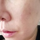 씨엘블루 | 모공앰플 콜라겐앰플 속건조 심한 피부 씨엘블루 앰플 리얼후기 (전/후샷 있음)