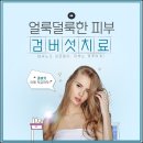 맑은피부과의원 네이버블로그