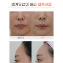 명가의원 네이버블로그