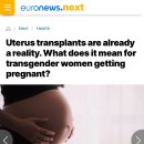 현실이 된 자궁이식, 트랜스여성이 임신한다는 것의 의미 이미지
