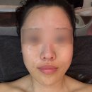 안양피부관리 고귀한에스테틱 작은얼굴수기 하이푸관리 후기