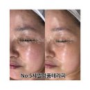 샤테라피 이미지
