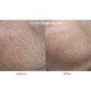 신천팰리스 | 잠실 마사지 잘하는 곳, 트러블 고민까지 해결하는 '박사한지현 K뷰티케어센터' 솔직 후기