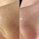 향천빌딩 | 둔산동피부관리 설브 둔산점에서 둔산동 모공관리로 블랙헤드랑 이별한 후기✨