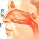 급성 비염 [acute rhinitis] 이미지