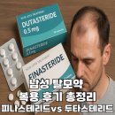 제1남성경로당 | 남성 탈모약 복용 후기 총정리( 피나스테리드vs 두타스테리드)