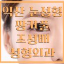 조성배성형외과의원 네이버블로그