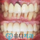 유니치과기공소 네이버블로그