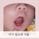 금릉로데오(여우야 상가 앞) | 운정 설소대 금릉 소아과 신생아 설소대 시술 후기(ft.BCG접종,1차 영유아검진)