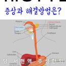 역류성 후두염 꼭 기억하세요 이미지