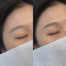 키닛브로우바