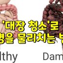 ‘대장 청소’로 만병을 물리치는 방법 이미지