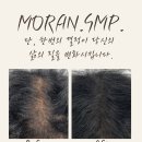 모란홍천