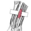 하트핏 휘트니스 이미지