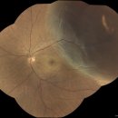 서울퍼시픽안과의원 이미지