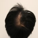 부산 맘모스헤어라인의원 이미지