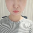 파리바게트 가양시드점 | [가양역 피부관리] 뷰티힐 / 리프팅 3000샷 + 물방울 초음파 즉각적인 후기