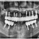 리브원치과의원 이미지