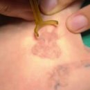 클린타투의원 이미지