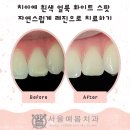 서울예봄치과 이미지