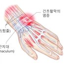 자세교정 필라테스 이미지