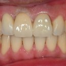 다연치과기공소 이미지