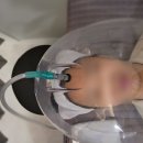 오투성형외과 이미지