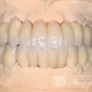 현대치과기공소 이미지