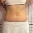 포이컨설팅 | [천안 신부]벨라피아천안점(+ 100%수기 마사지 여름 다이어트 복부관리)