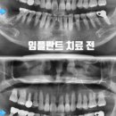 고운가이드치과병원 이미지