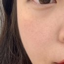 제씨네일 | 고양 덕은동 피부 네일샵 추천 제씨네일 | 고양 일산 플라즈마 기미 잡티 제거 후기!