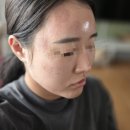 싹다팔아 | 서면 새얀에스테틱 원모드 효과,멍,통증까지 싹 다 솔직후기