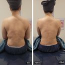 (주)서윤 | 광화문피부관리 울쎄라 리프팅,상체 케어 신부 웨딩 준비 서윤피부맑음 명동점