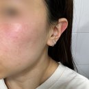 마디케어 | W3. 강북구 웨딩케어 전문 샵 에스테틱마디다수유 피부 관리 후기