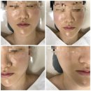 [경주] 경주 충효동스킨케어 레이나에스테틱 찐후기(+가격)