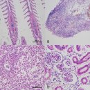 Aeromonas salmonicida subsp. salmonicida감염 쏘가리의 출혈성 아가미병 이미지