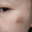 페이스필터의원 이미지