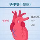 부정맥 초기 원인 부정맥 검사법 심장 운동 이미지