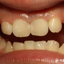 서울아산이치과의원 이미지