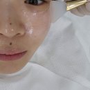 미지뷰티클리닉 | 미지뷰티클리닉] 광주 운암동 피부관리 추천