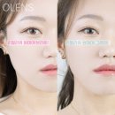 밀키톤업 직경큰 빅사이즈 해린렌즈 오렌즈 리얼리쉬 원데이 브라운, 그레이 후기