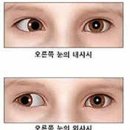 아이윤안과병원 이미지