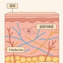 강서리 | 강서리쥬란, 손주사 vs 기계주사, 뭐가 더 효과 있을까?