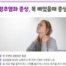 목 삐었을 때 목통증, 경추염좌 의심 (운동, 교통사고) 이미지