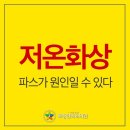 파스 저온화상의 원인일 수 있다 이미지