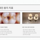 에이블치과기공소 이미지