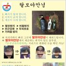 탈모야안녕 이미지