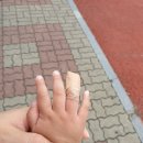 연세조은의원 네이버블로그